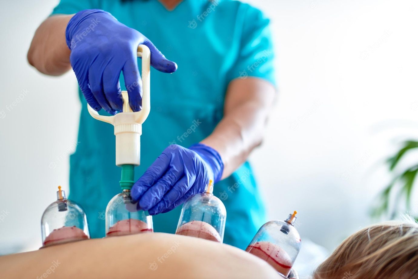 Hijama