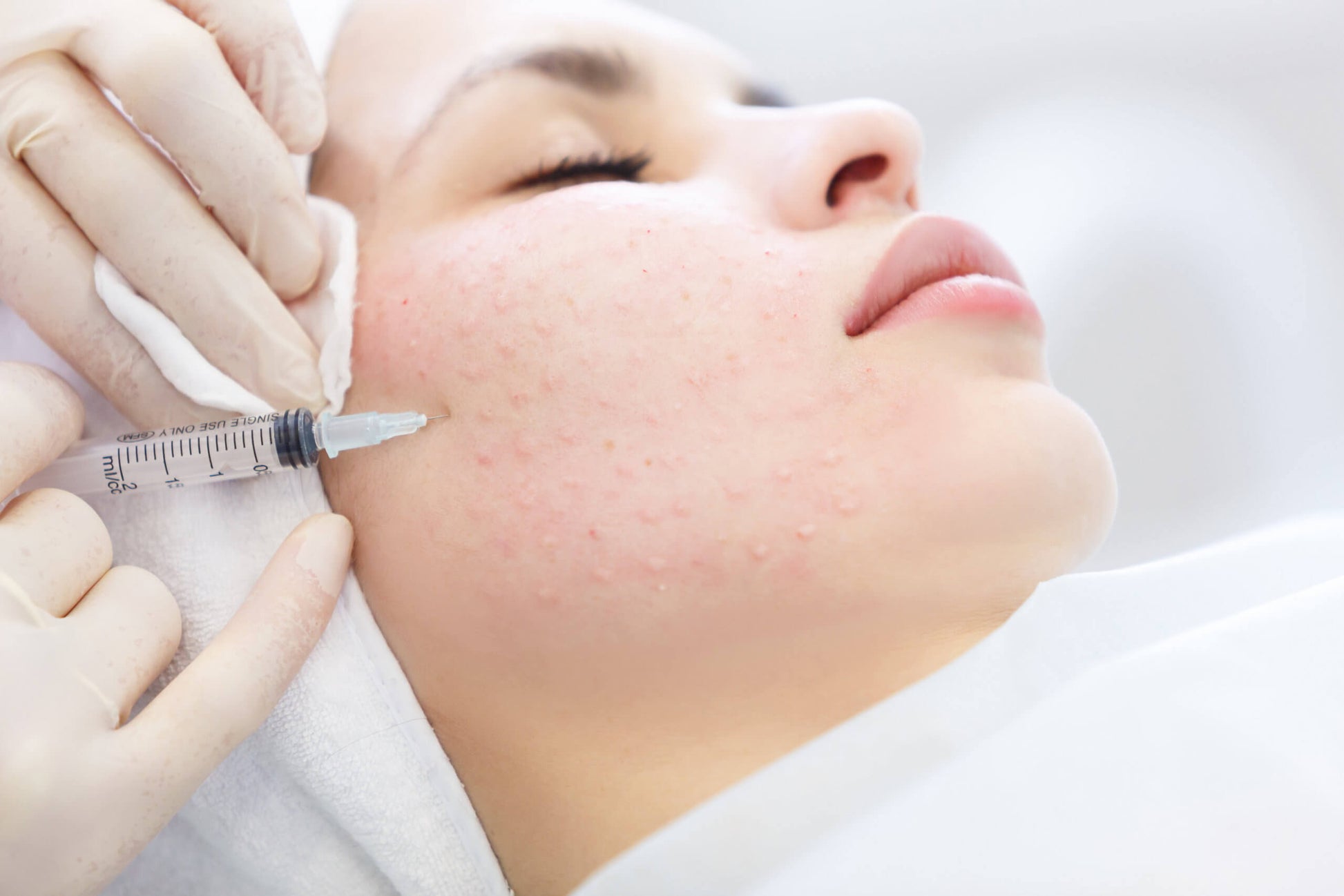 Hydra-facial