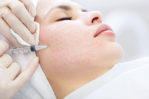 Hydra-facial